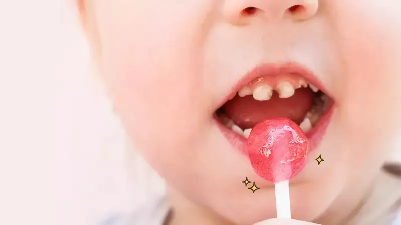 3 Cara Mencegah Karies Hitam di Gigi Anak