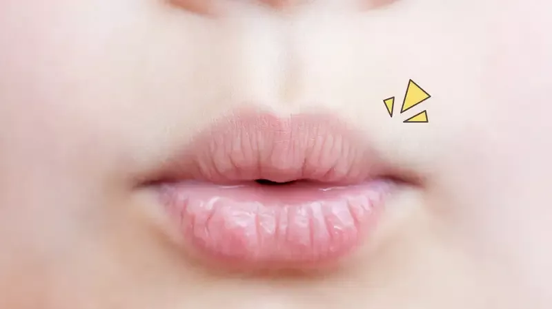 6 Penyebab Bibir Kering pada Anak yang Mengganggu Aktivitas