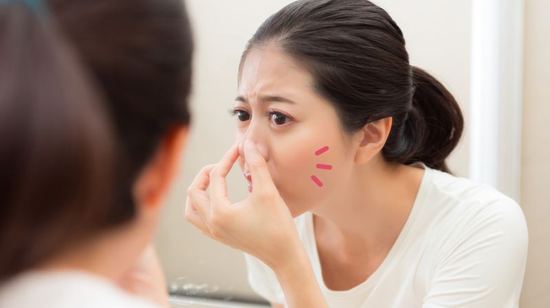 5 Cara Ampuh Atasi Jerawat di Hidung