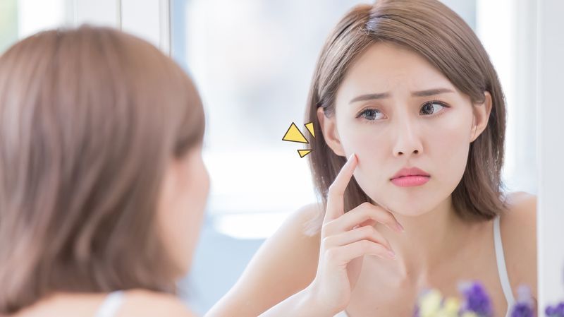 4 Bahan Skincare Alami untuk Menghilangkan Flek Hitam