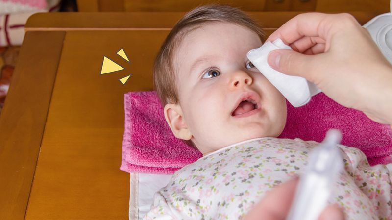 5 Penyebab Mata Bayi Belekan, Bisa Karena Alergi atau Infeksi, Pahami Cara Mengobatinya, Moms!