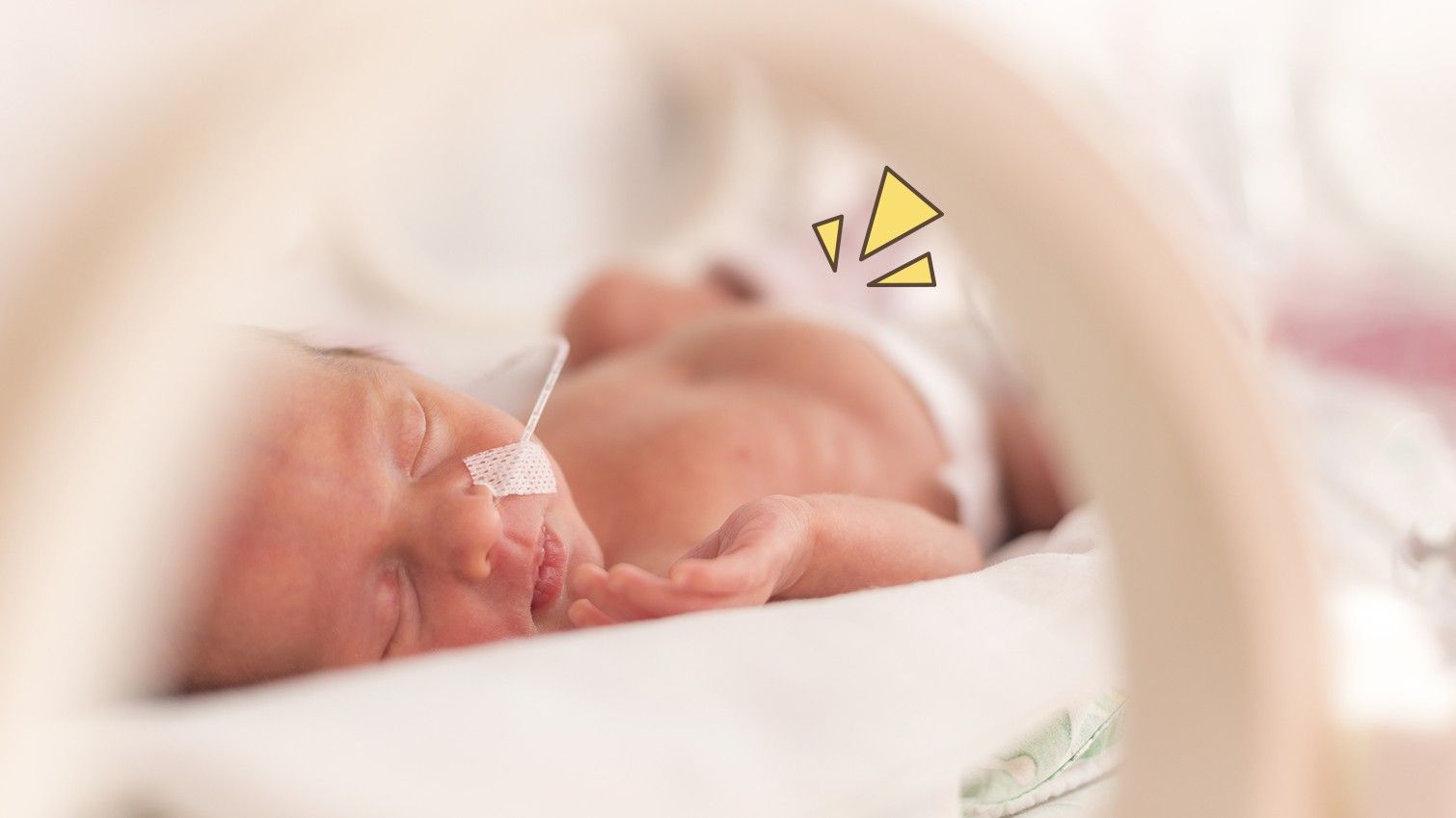 Inilah Fakta-Fakta Bayi Lahir Prematur yang Harus Moms Ketahui