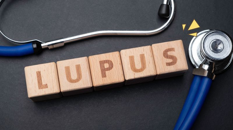 Penyakit Lupus pada Anak, Begini Cara Mendeteksinya