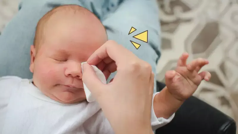Mata Bayi Belekan? Cek Cara Mengatasinya!