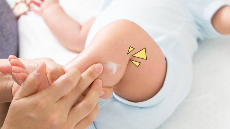 Cegah Alergi Dengan Melembapkan Kulit Bayi