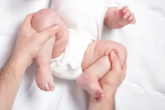 Mengenal Displasia Pinggul Pada Bayi