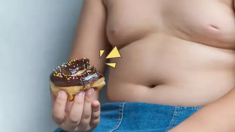 Obesitas pada Anak, Ini 3 Miskonsepsi Paling Umum