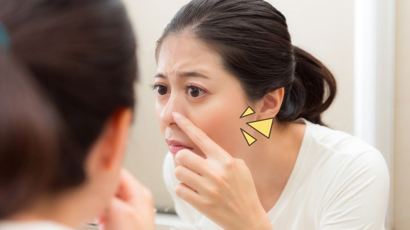Jerawat di Hidung: Penyebab, Cara Mencegah dan Mengatasinya, Cari Tahu, Yuk!