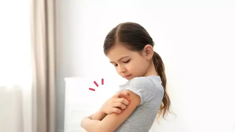 5 Penyebab Alergi pada Anak di Bagian Kulit dan Cara Mengatasinya