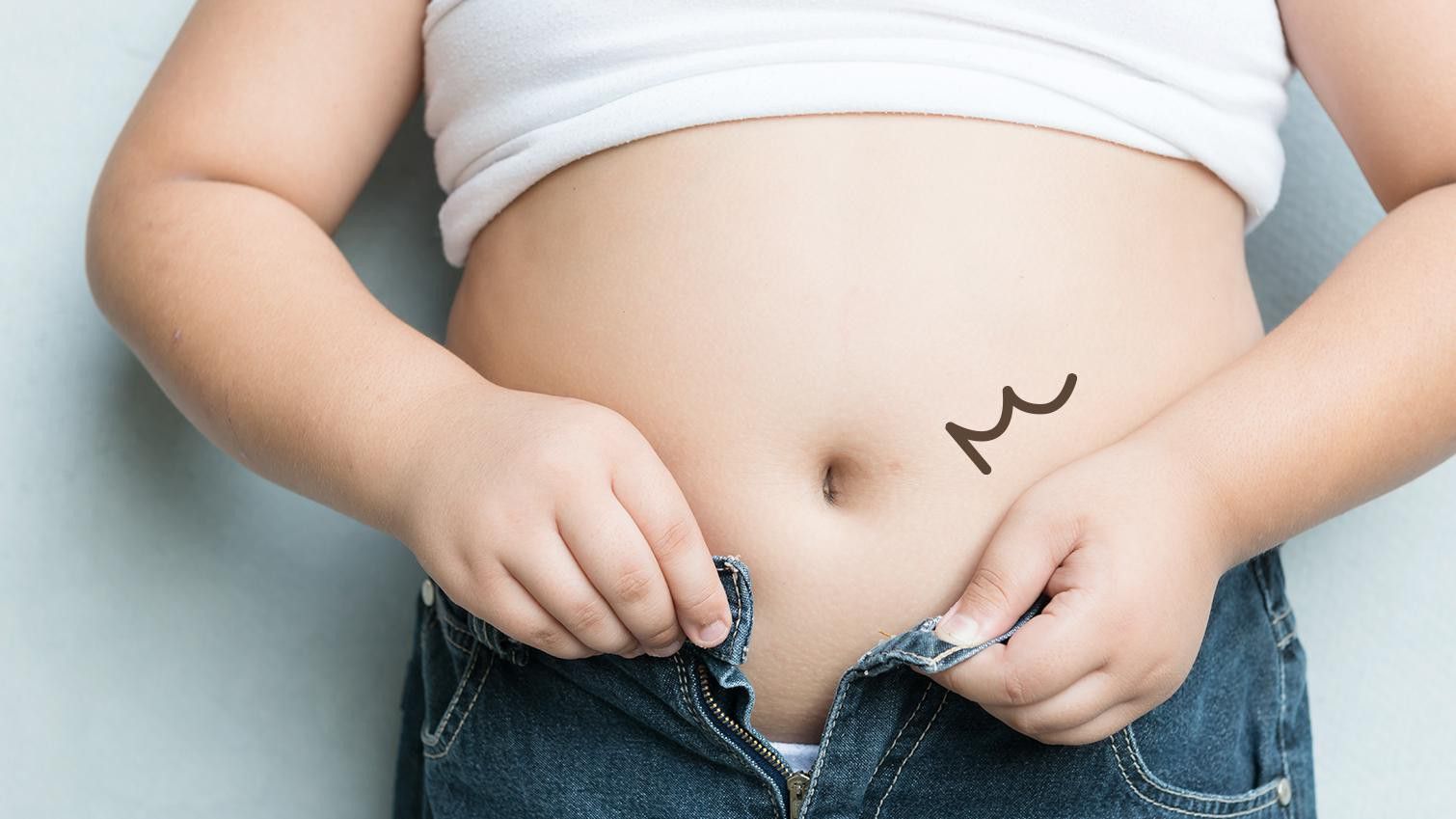 Ketahui Bahaya Fatty Liver Disease Yang Mengintai Anak Obesitas