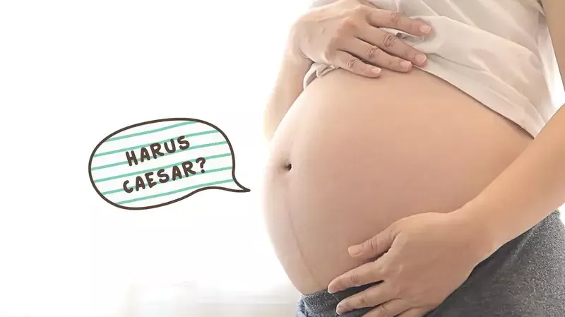 Bayi yang Lahir Caesar Cenderung Miliki Berat Badan Berlebih?