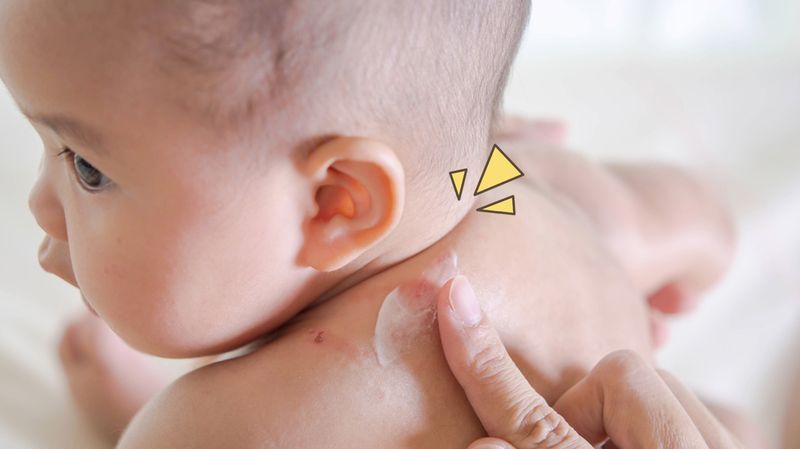 4 Cara Melindungi Bayi dari Gigitan Serangga, Catat!