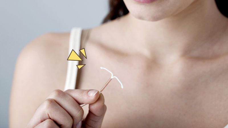 Memahami Cara Pemasangan KB IUD untuk Cegah Kehamilan
