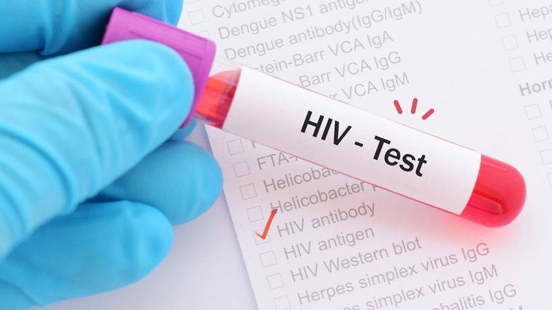 5 Cara Penularan HIV AIDS Menurut Studi, Bukan Hanya Seks Bebas!