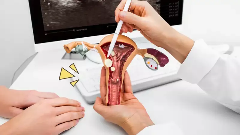 Kenali Fungsi Endometrium Wanita dan Jenis Penyakit yang 'Mengintai'