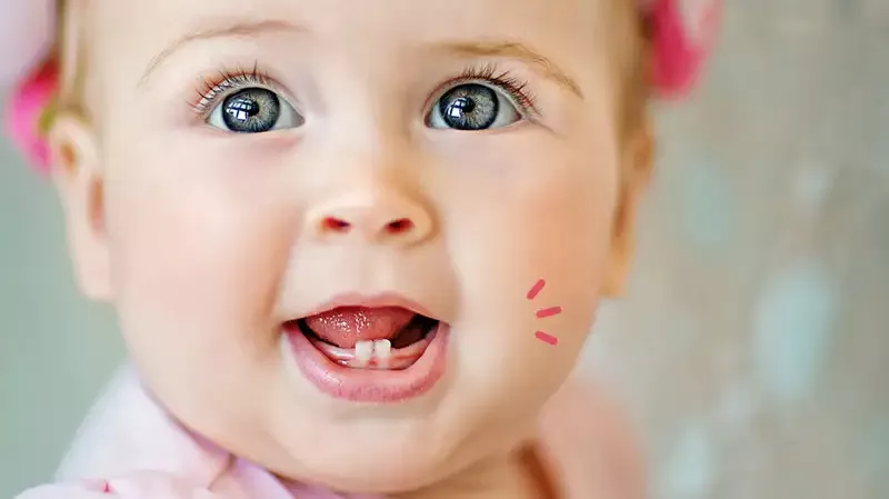 5 Fakta Tentang Kesehatan Gigi Bayi yang Harus Moms Tahu