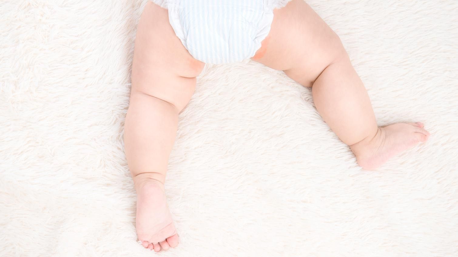 Ini Penyebab dan Cara Mengatasi Ruam pada Kulit Bayi
