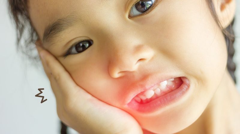 5 Penyebab Gigi Keropos di Usia Muda, Kenali dan Waspadai!