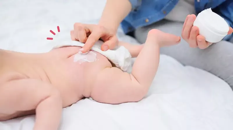 20 Produk Krim Ruam Popok Bayi Terbaik, Aman untuk Si Kecil!