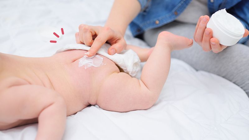 20 Rekomendasi Krim Ruam Popok Bayi Terbaik, Aman untuk Si Kecil!