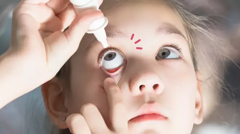 15 Rekomendasi Obat Tetes Mata Anak Terbaik dan Aman