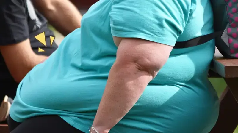 Obesitas: Gejala, Penyebab, dan Cara Mengatasinya, Pahami, Ya Moms!