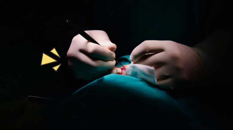 5 Jenis Operasi Batu Ginjal dan Efek Samping Pasca Tindakan