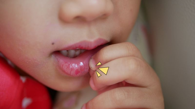 7 Penyebab Bibir Bayi yang Kering, Bisa Dicegah!