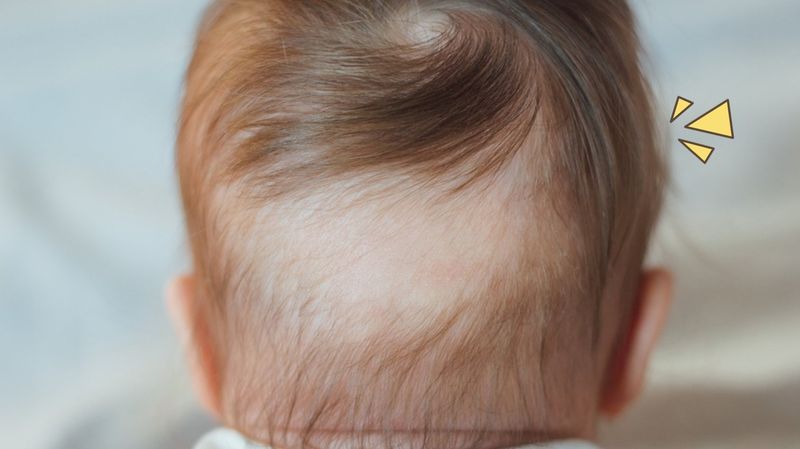 Rambut Bayi Rontok, Kenali Penyebab dan Cara Mengatasinya!