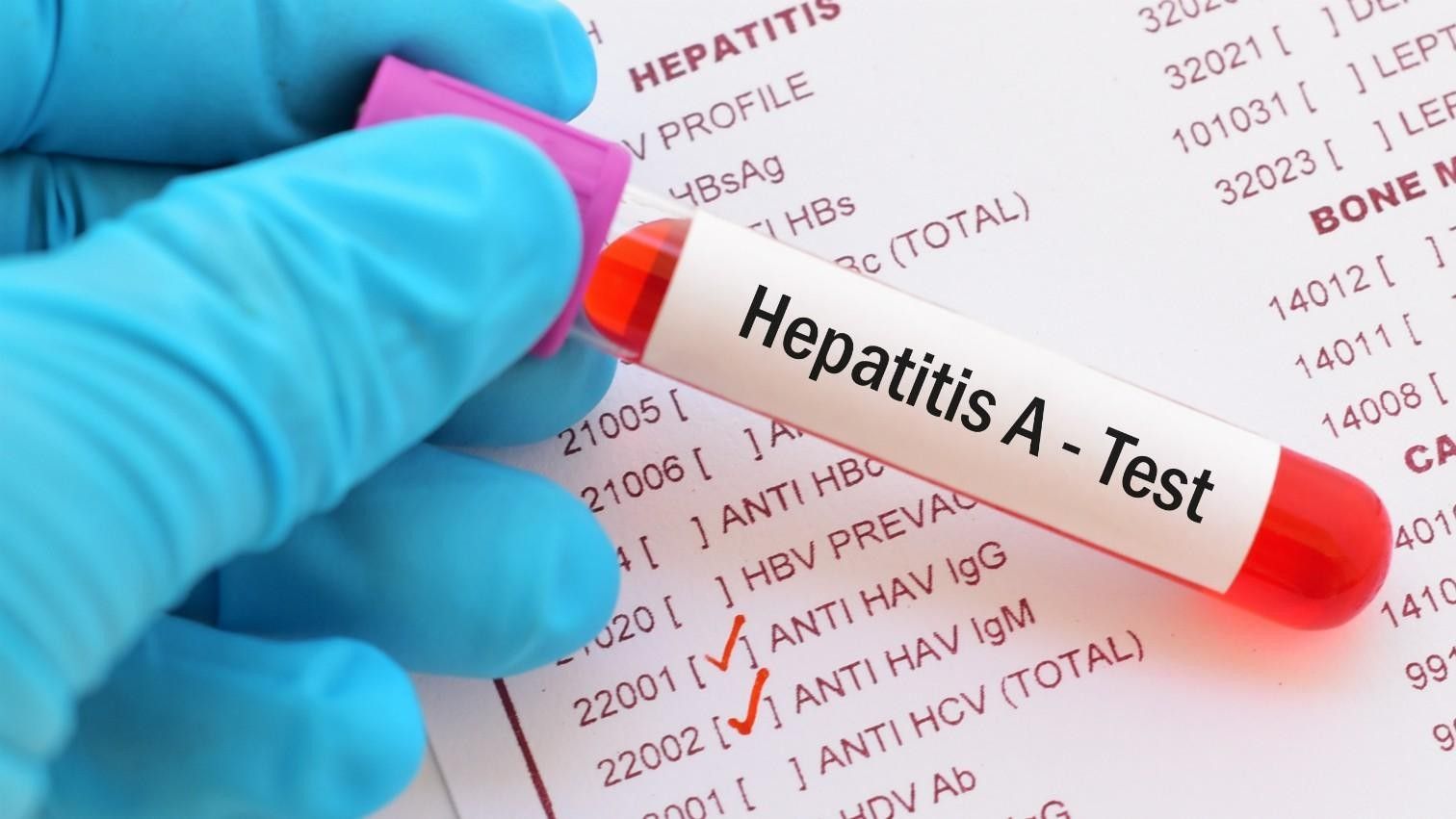 Apa Beda Hepatitis A, B, dan C?