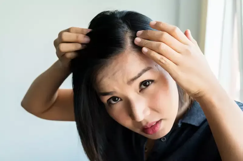 Ini 5 Masalah Kesehatan yang Jadi Penyebab Rambut Rontok Setiap Hari